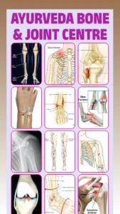 Ayurveda bone & joint centre (1)